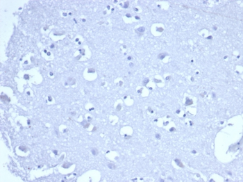 TACSTD2 Antibody