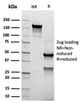 TACSTD2 Antibody