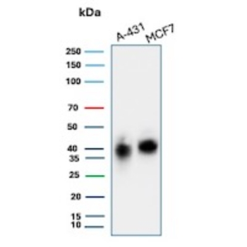 TACSTD2 Antibody