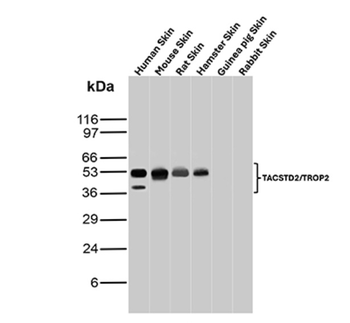 TACSTD2 Antibody