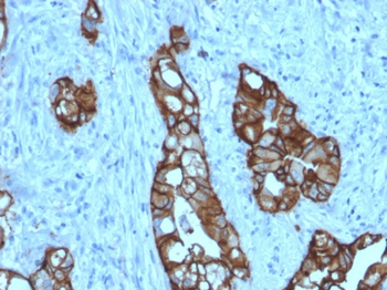 TACSTD2 Antibody
