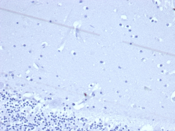 TACSTD2 Antibody