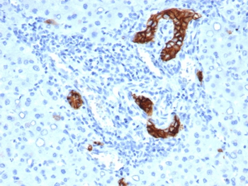 TACSTD2 Antibody