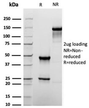 TACSTD2 Antibody