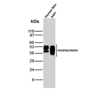 TACSTD2 Antibody