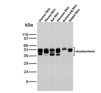 TACSTD2 Antibody