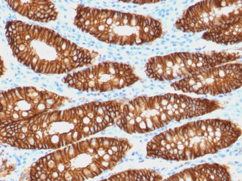 EpCAM / CD326 (Epithelial Marker) Antibody