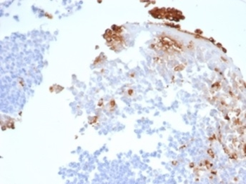 MPO Antibody