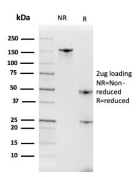 ITLN1 Antibody