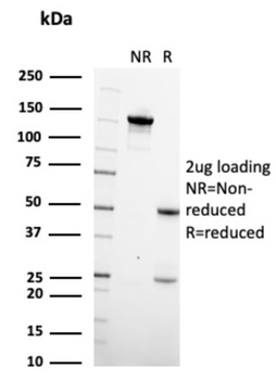 ITLN1 Antibody