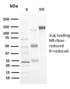 CD73 (Immuno-Oncology Target) Antibody