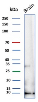 S100B Antibody