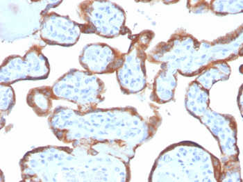 TIMP2 Antibody