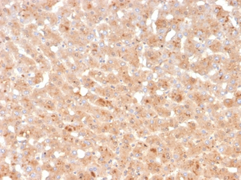 TTR Antibody