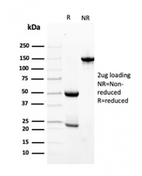 TTR Antibody