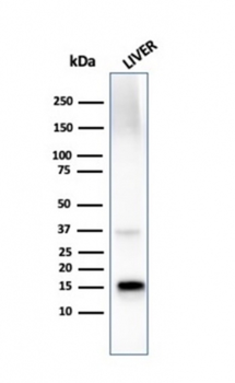 TTR Antibody