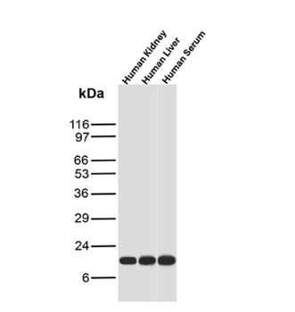 TTR Antibody