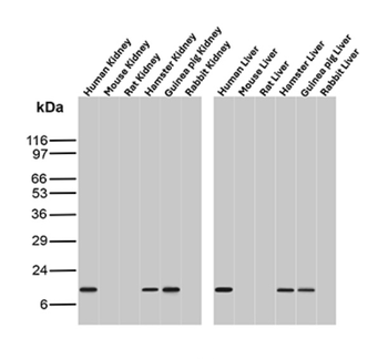 TTR Antibody