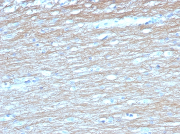 UCHL1 Antibody
