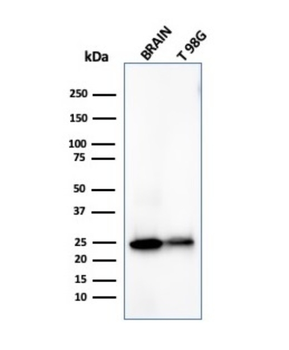 UCHL1 Antibody