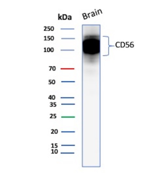 INSM2 Antibody