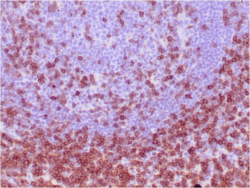 CD7 Antibody
