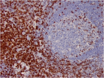 CD7 Antibody