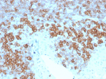 CD27 Antibody