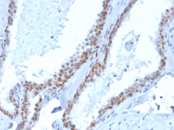 Recombinant p40 (deltaNp63) (Squamous, Basal & Myoepithelial Cell Marker) Antibody