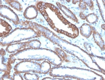 CDH1 Antibody
