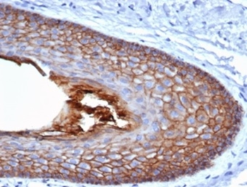 CDH1 Antibody