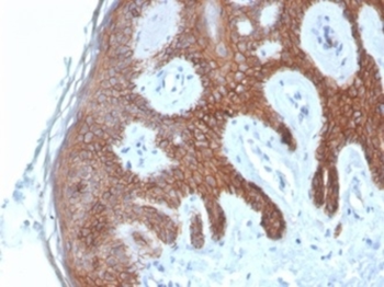 CDH1 Antibody
