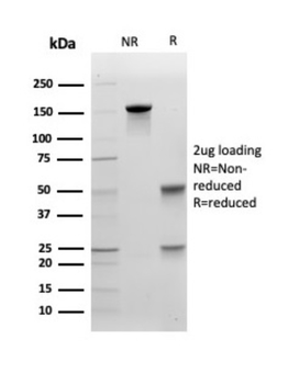 CDH1 Antibody