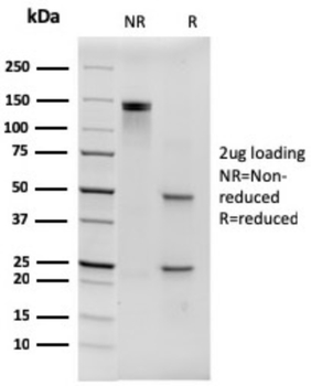 Hexa-histidine (Epitope Tag) Antibody