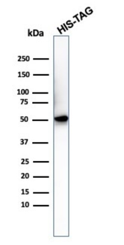 Hexa-histidine (Epitope Tag) Antibody