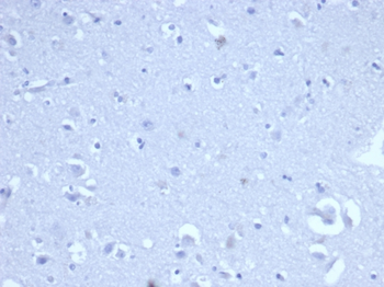 CD8A Antibody