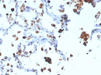 Napsin A (Lung Adenocarcinoma Marker) Antibody