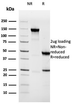 Napsin A (Lung Adenocarcinoma Marker) Antibody