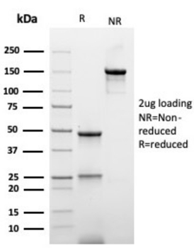 Recombinant Hexa-histidine (Epitope Tag) Antibody
