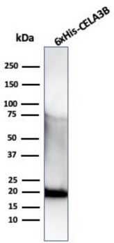 Recombinant Hexa-histidine (Epitope Tag) Antibody