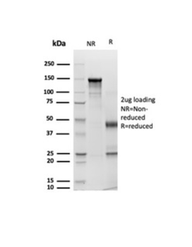 Recombinant Cytokeratin, pan (Epithelial Marker) Antibody