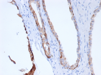Recombinant Cytokeratin, pan (Epithelial Marker) Antibody