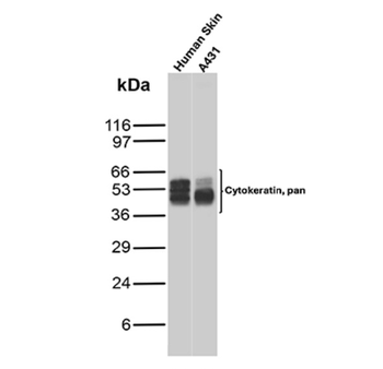 Recombinant Cytokeratin, pan (Epithelial Marker) Antibody