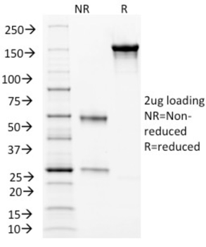 ENG Antibody
