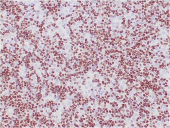 DNTT Antibody