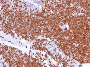 DNTT Antibody