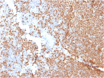 DNTT Antibody