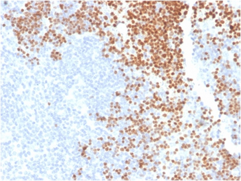 DNTT Antibody