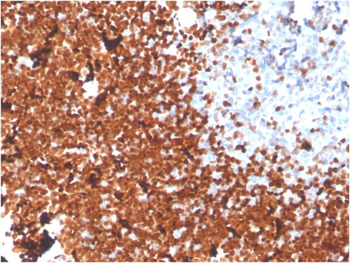 DNTT Antibody