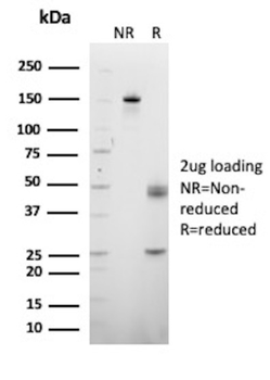 DNTT Antibody